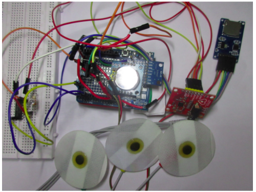 Holter-monitor